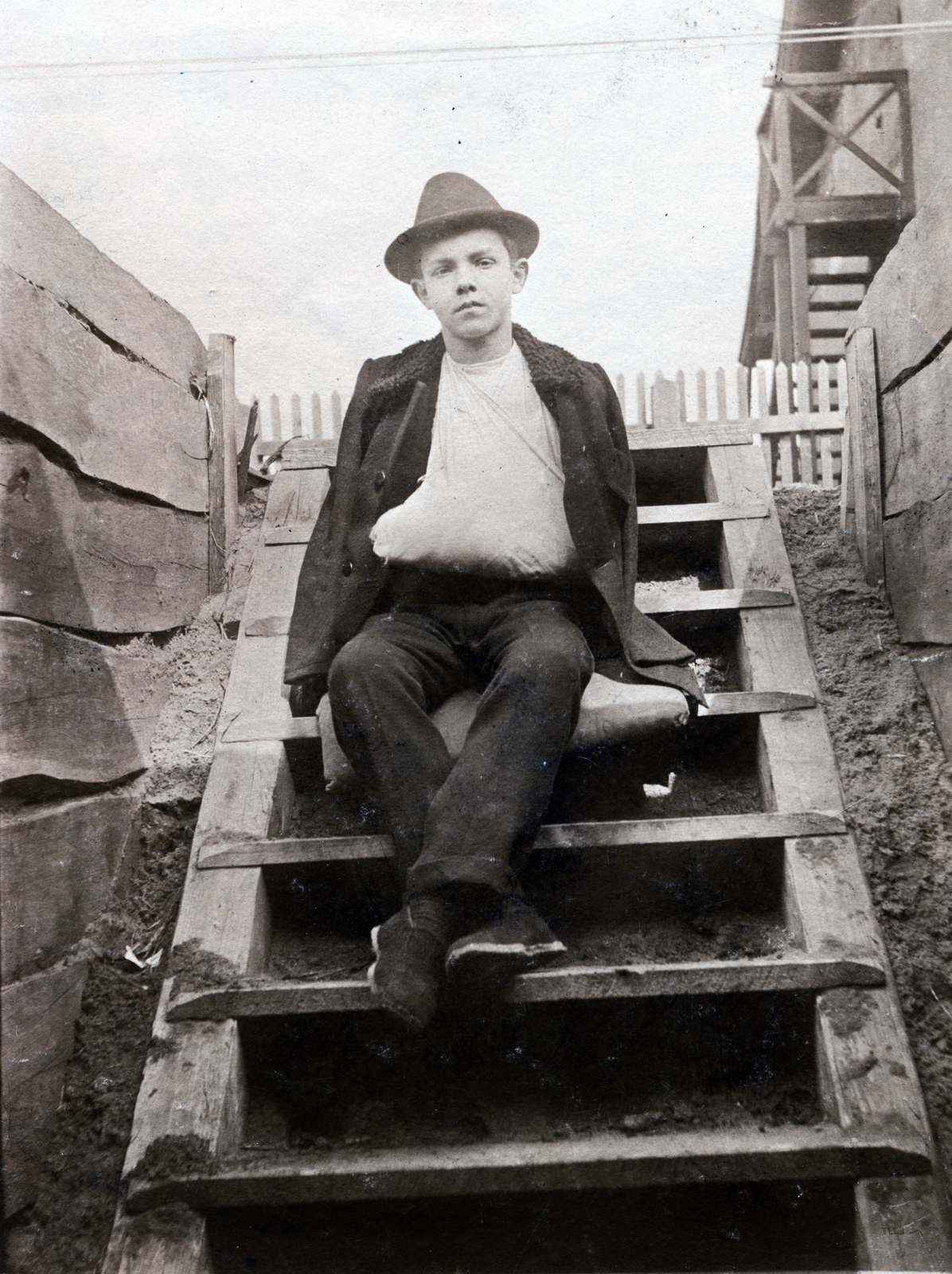 1922, Közösségi Szociális Szövetkezet, Best of, sitting on stairs, triangular bandage, Fortepan #223444