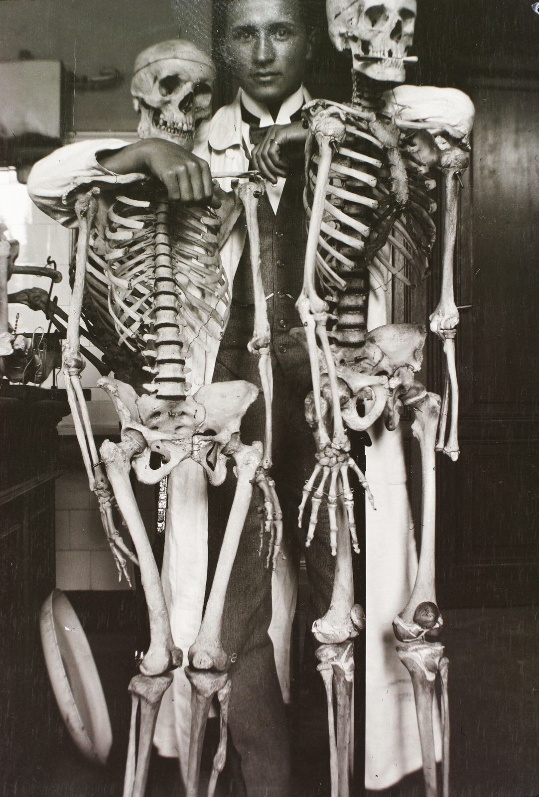 1911, Schmidt Albin, skeleton, doctor, Fortepan #86020